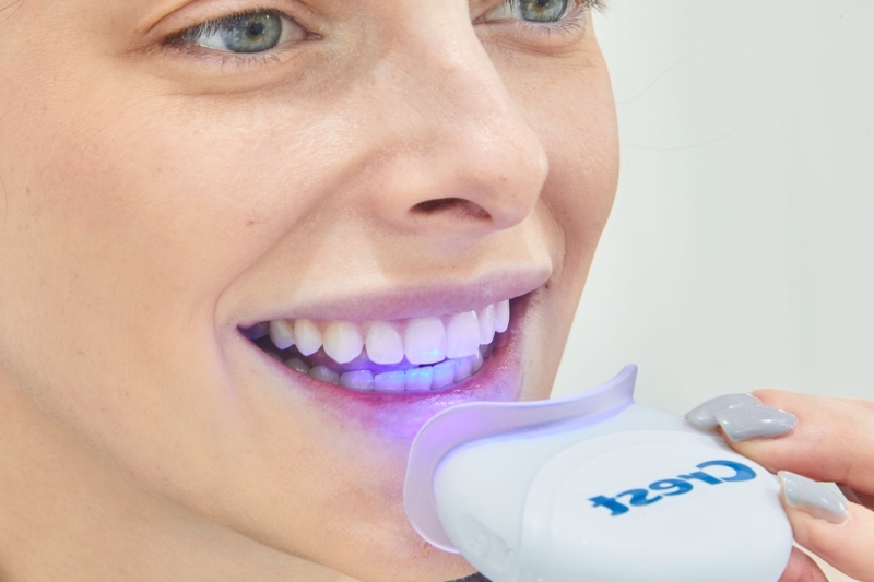 A set of shiny white teeth can be a thing of envy, but not many are up for sacrificing coffee, tea, pasta (or the accompanying wines). With these 7 LED teeth whitening kits, you can achieve a brighter smile at home and say goodbye to stains (even the old ones).