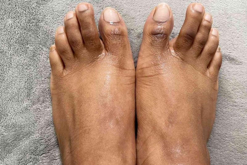 If you’re hard on your feet, chances are it shows as dry skin, cracked heels, or hardened calluses. To revive rough feet, a foot peel or mask is an easy, low effort way to get ready for summer sandals. These InStyle editor-tested picks are proven to make feet smooth, soft, and—dare we say it—sexy.