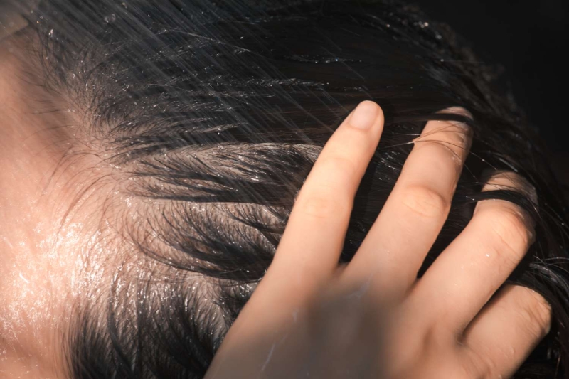 Your scalp is the foundation from which healthy, vibrant hair grows. Whether you struggle with dryness, oiliness, or sensitivity, here are 10 ways to keep your scalp healthy.